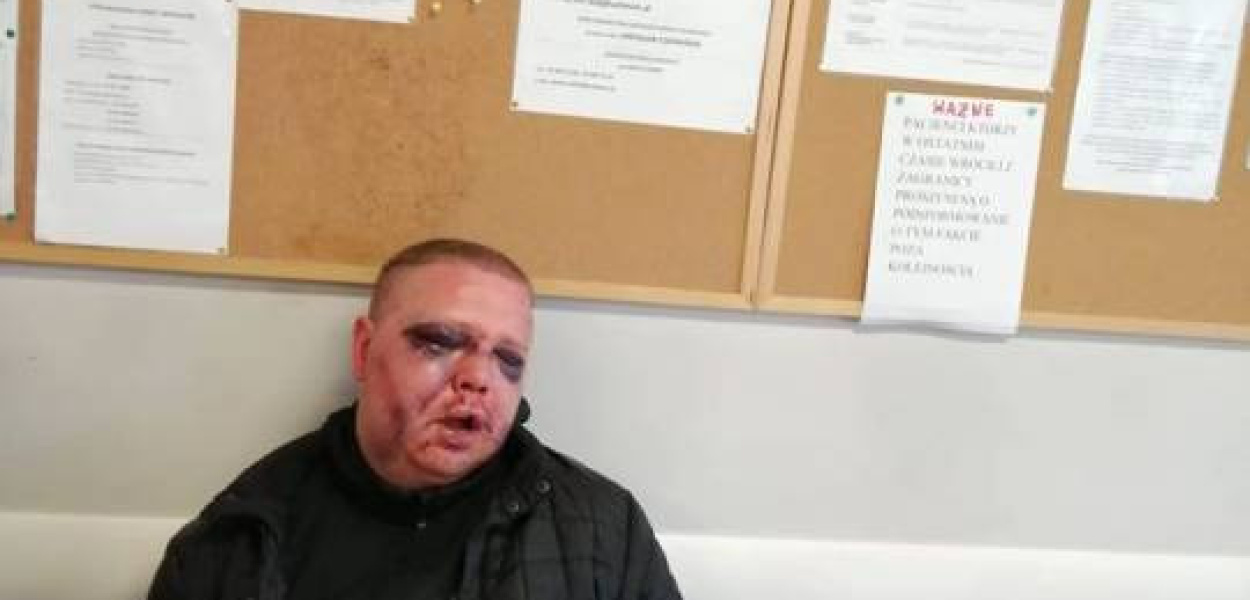 Brutalne pobicie w Mławie? Relacja matki. Stanowisko policji