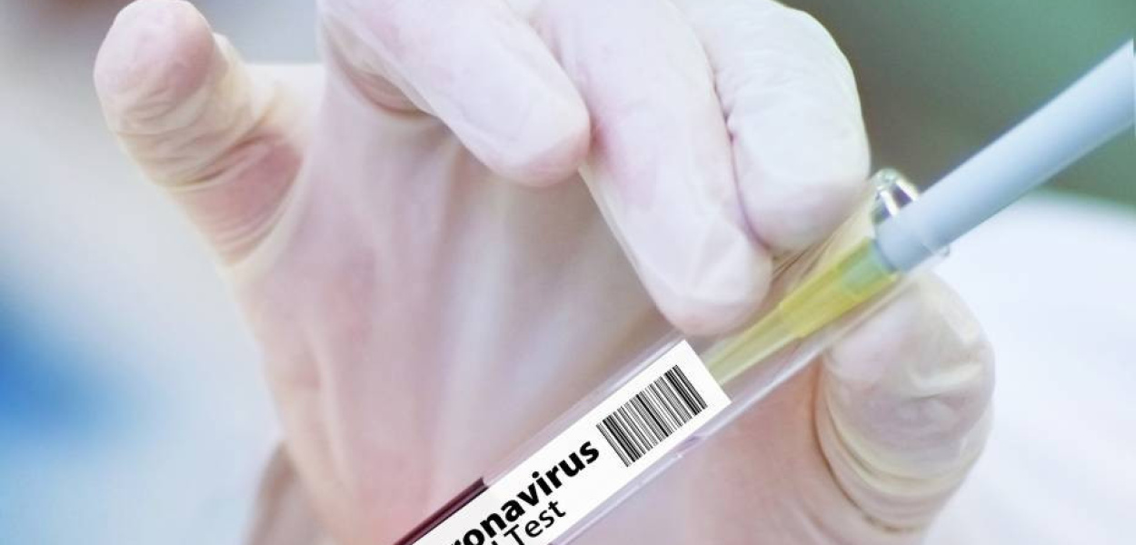 Już za trzy dni w Mławie badania na koronawirusa