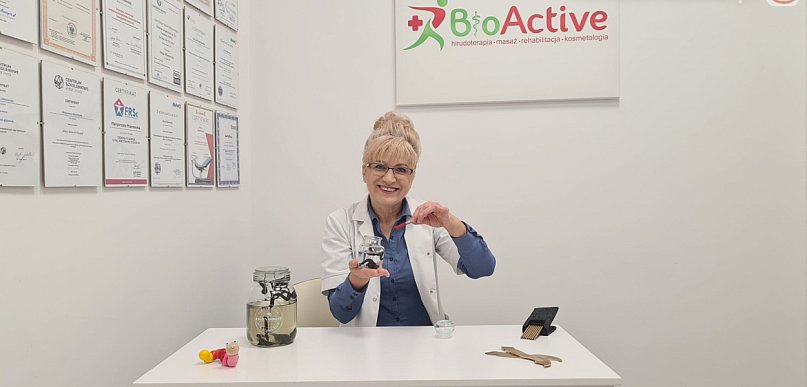 Pijawki kontra żylaki - czy warto spróbować?